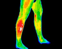 Thermal_Imaging